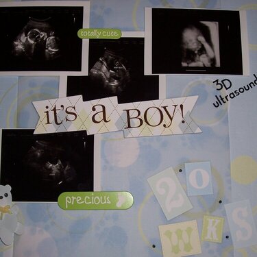 20 WK Ultrasound - It&#039;s A Boy!