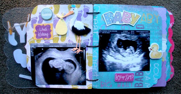 Ultrasound Pictures Mini Album Page 3 - Project Idea 