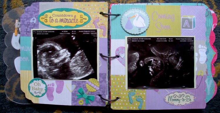 Ultrasound Pictures Mini Album Page 4