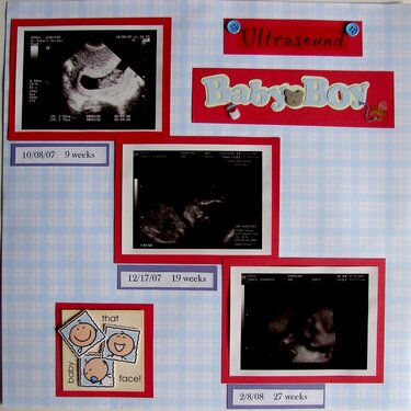 Baby Boy ultrasound