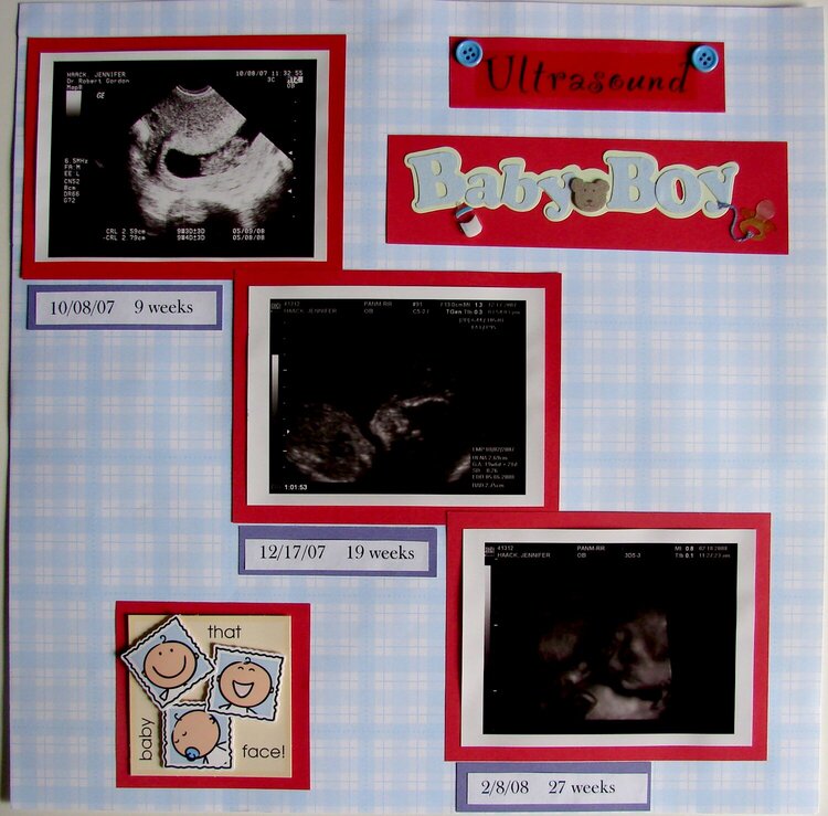 Baby Boy ultrasound