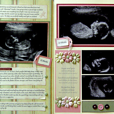 Ultrasounds and The Second Trimester