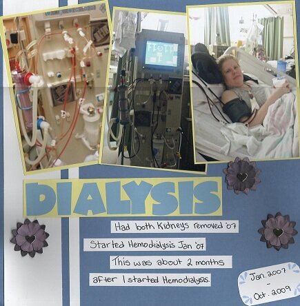 Dialysis