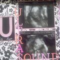 U is for Ultrasound