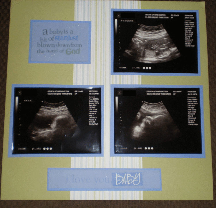 Ultrasound Pics