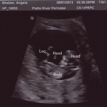 Our Little Girl - 11w0d