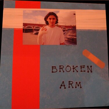 Broken Arm