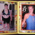 Weight Loss Surgery Accordian Book Page 1