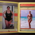 Weight Loss Surgery Page 2