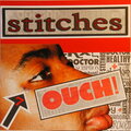 Stitches