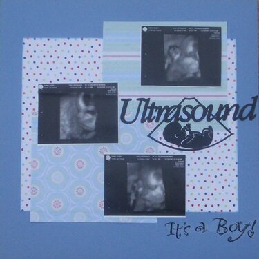 Ultrasound