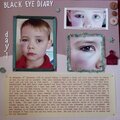 Black Eye Diary