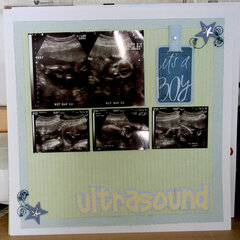 U Is For Ultrasound