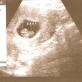 Baby # 2 at 8 weeks &amp; 2 days