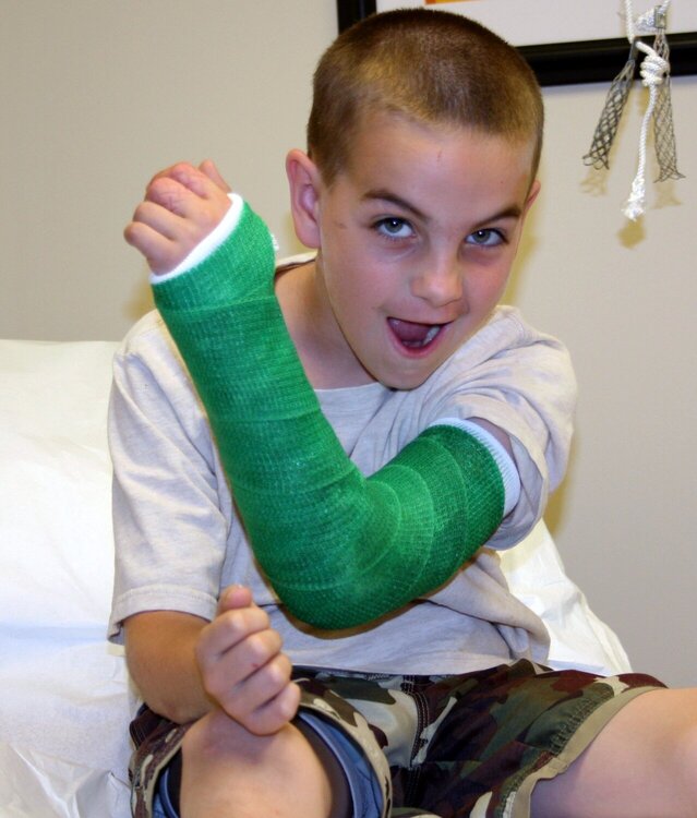 Sporting his cast