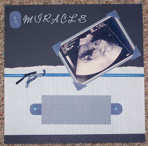 Miracle ultrasound LO