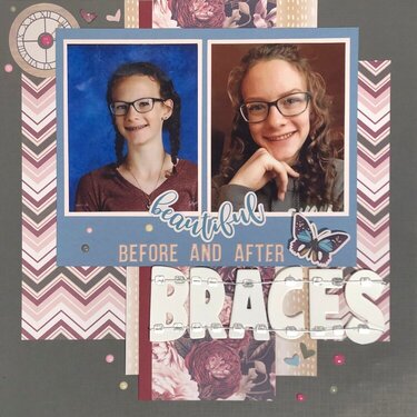 Beautiful - before and after Braces