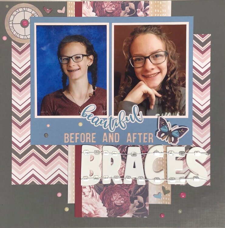 Beautiful - before and after Braces