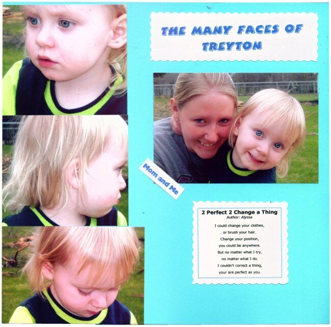 Many Faces of Treyton