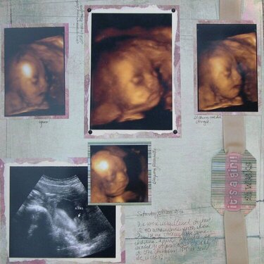 Kiera - 3D Ultrasound