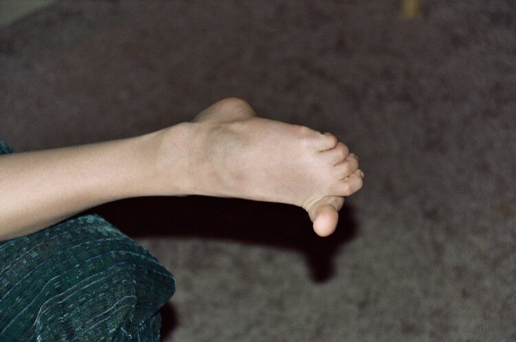 March 9 - Nick&#039;s foot