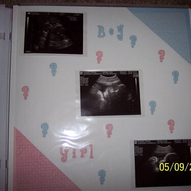 UltraSound pictures