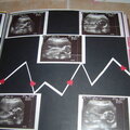 Baby/ultrasound