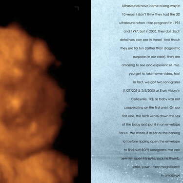 Ashton Pregnancy Book 2004-2005: 3D Ultrasounds