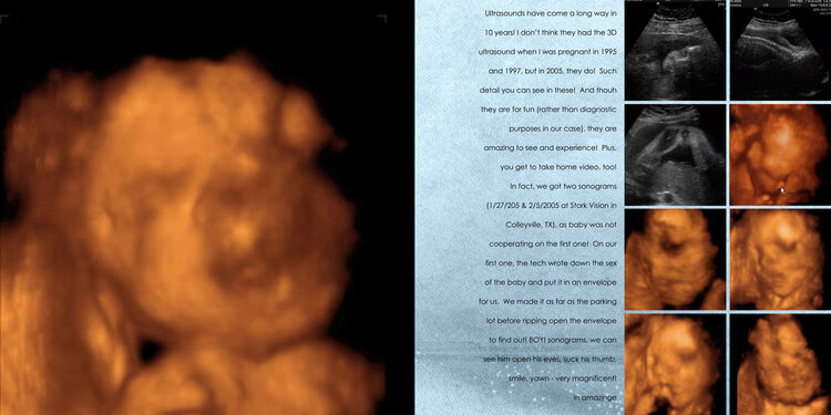 Ashton Pregnancy Book 2004-2005: 3D Ultrasounds