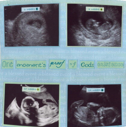 Ultrasound Pictures
