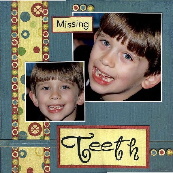 Missing Teeth