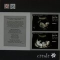 Create --Ultrasound Page --PRIMA flowers