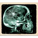 Inkadinkado - Clinical Halloween Collection - Wood Mounted Stamps - X-Ray Skull
